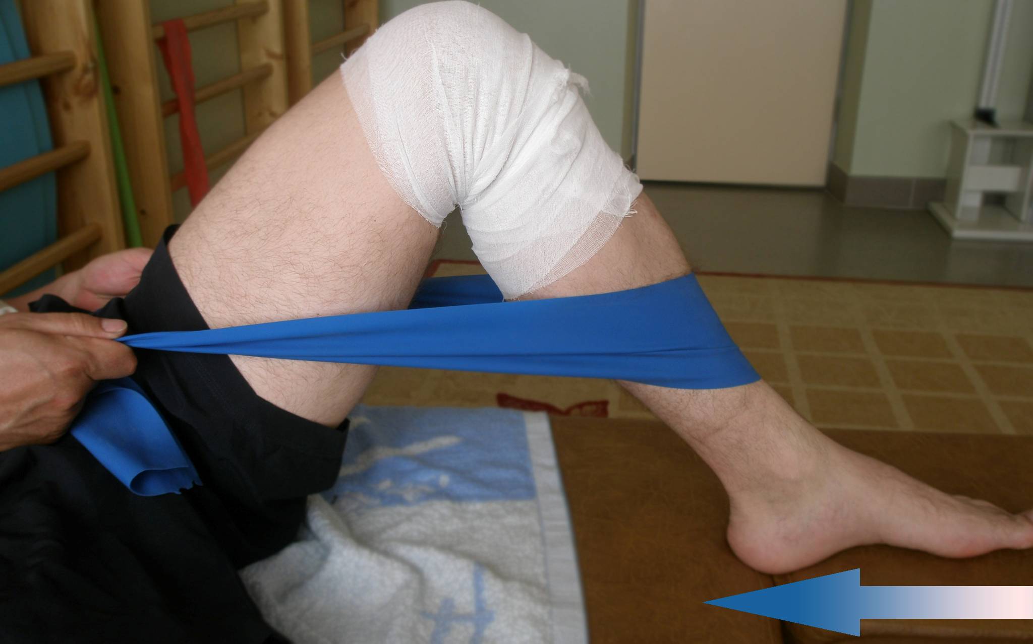 восстановление после перелома колена